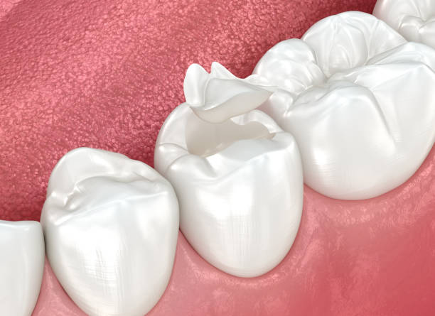 Best Root Canal Treatment  in Port Lavaca, TX