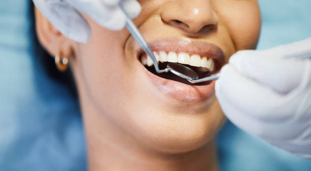 Best Dental Fillings (Composite and Amalgam)  in Port Lavaca, TX